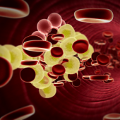 Cholesterol Analysis