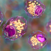 Total Lipid Fatty Acid Analysis